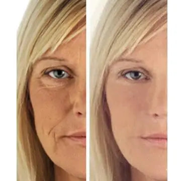 Woman face close-up, split before-and-after halves with reduced fine lines