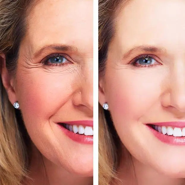 Woman face close-up, split before-and-after halves showing smoother, brighter skin