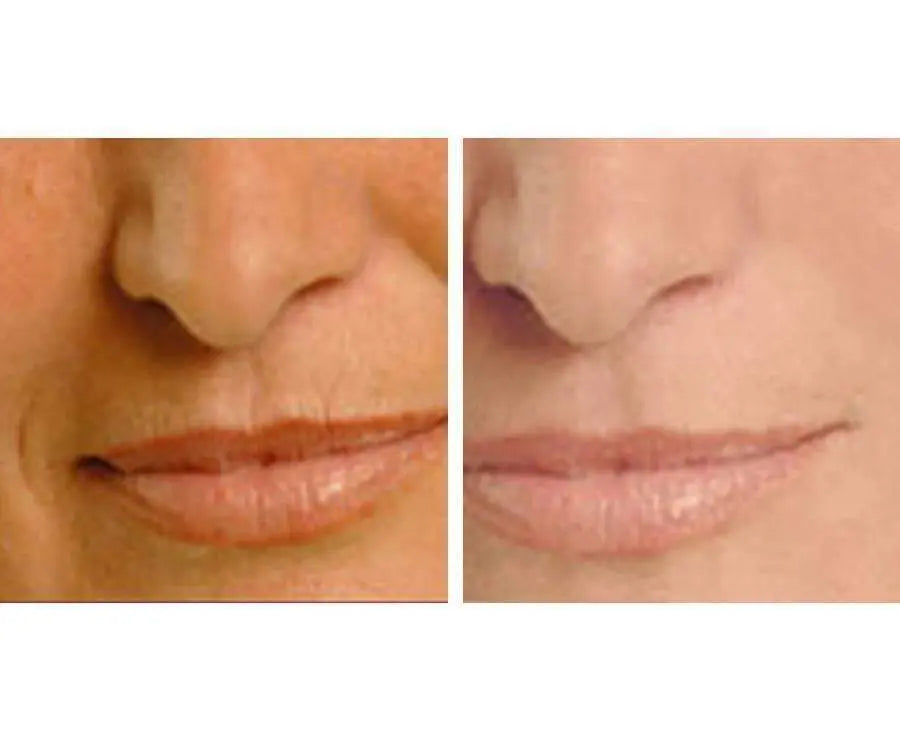 Close-up of lips and chin, split before-and-after halves for moisturized look